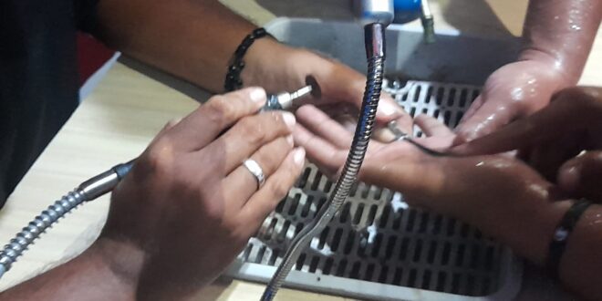 Demi Cincin Persahabatan, Jari Pelajar Nyaris Bengkak Parah, Damkar Kuningan Turun Tangan!