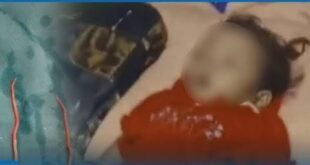 Tragedi di Sukabumi, Balita Meregang Nyawa Usai Tubuhnya Digerogoti 1 Kg Cacing!