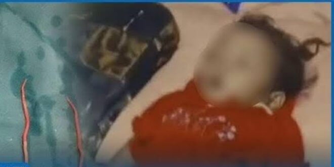 Tragedi di Sukabumi, Balita Meregang Nyawa Usai Tubuhnya Digerogoti 1 Kg Cacing!