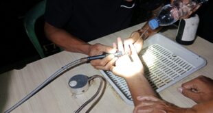 Cincin Nyangkut di Jari Remaja, Damkar Kuningan Diminta Tolong Tengah Malam